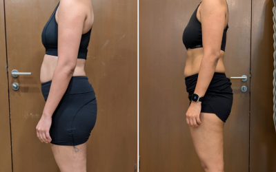 Weight Loss
